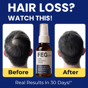 FEG Plus Hair Growth Spray – Fast Hair Regrowth Formula